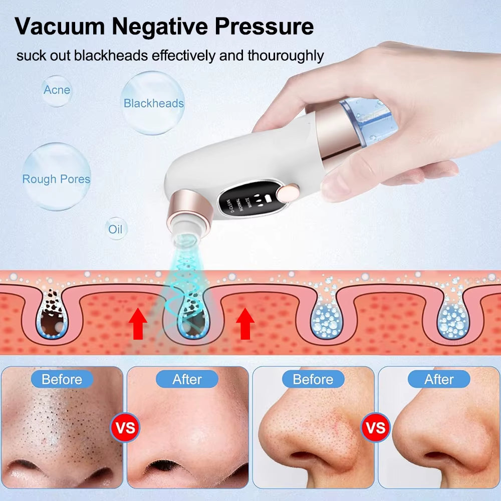 Blackhead Remover Electric Black Head Remover Pore Vacuum Cleaner Micro Small Bubble Rechargeable Water Cycle Black Dot Remove